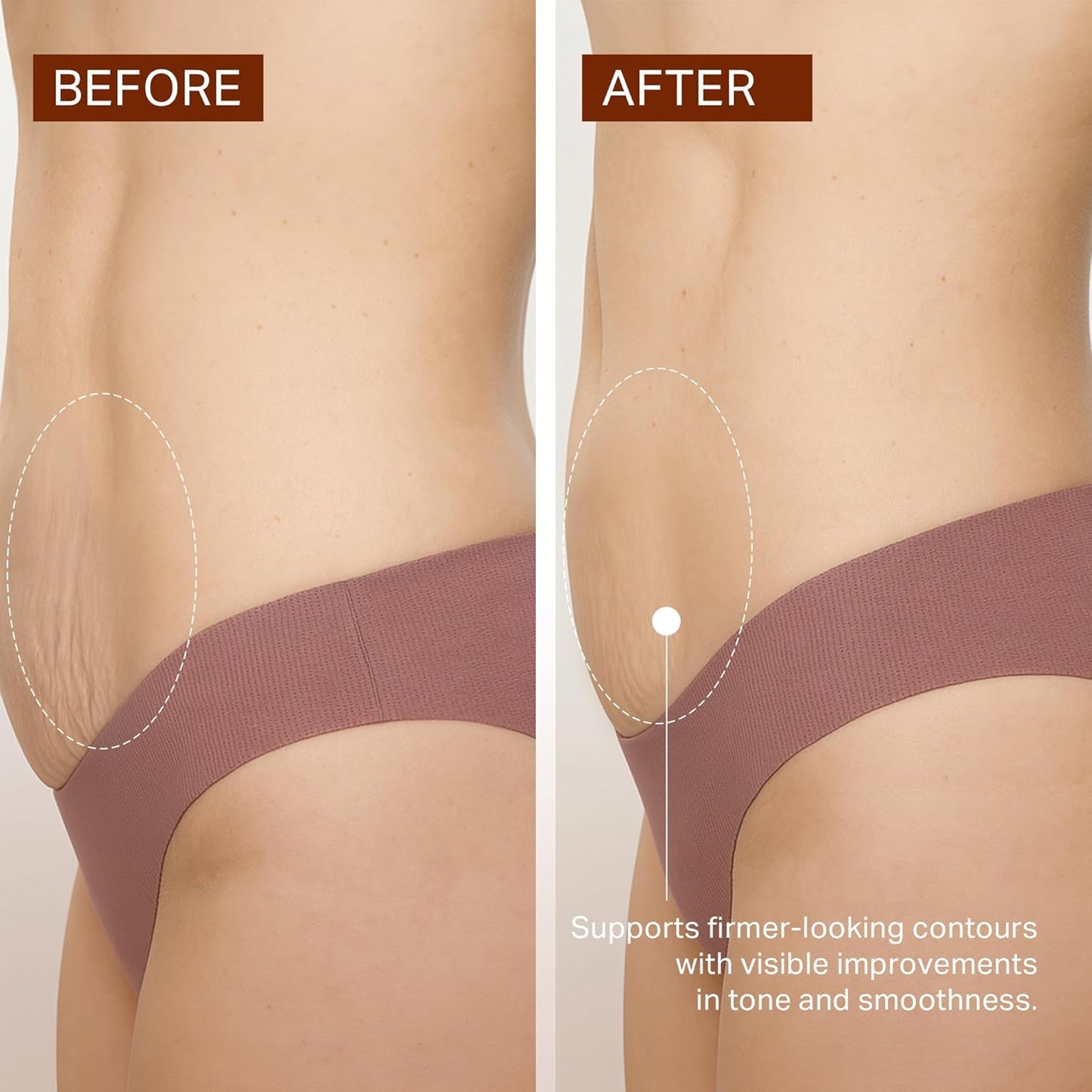 depology Caffeine Body Firming Serum Oil – Non-greasy Hydrating Body Glow Dual-Phase Oil for Dry, Aging Skin with Gua Sha Tool – Skin Tightening Oils with Squalane, Camellia & Caffeine – 5.07 fl oz