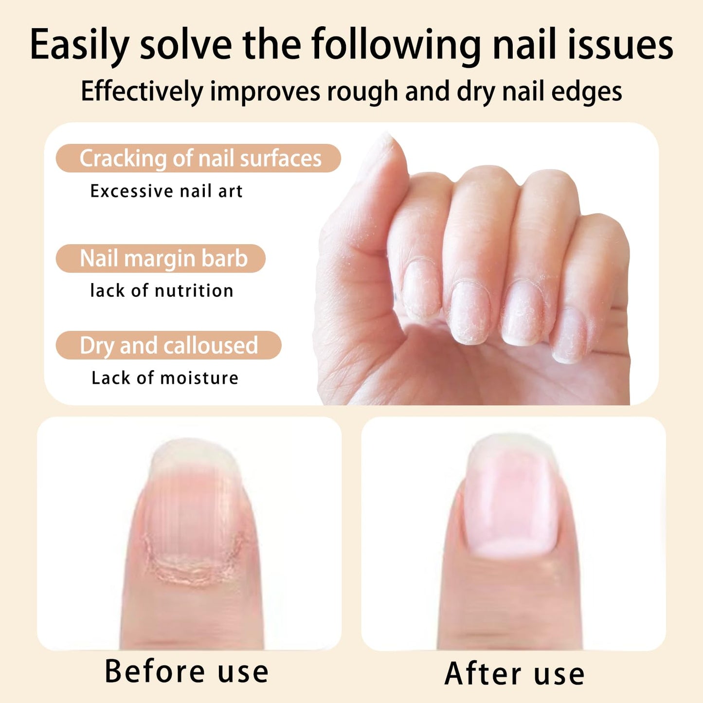 12pcs Cuticle Oil Pen Sweet Almond Nail Growth Serum and Repair Treatment Hydrating Oil for Dry Cuticles and Skin Cuticle Buddy Revitalize Nails with Radiant Cosmetics' Nail Growth Oil