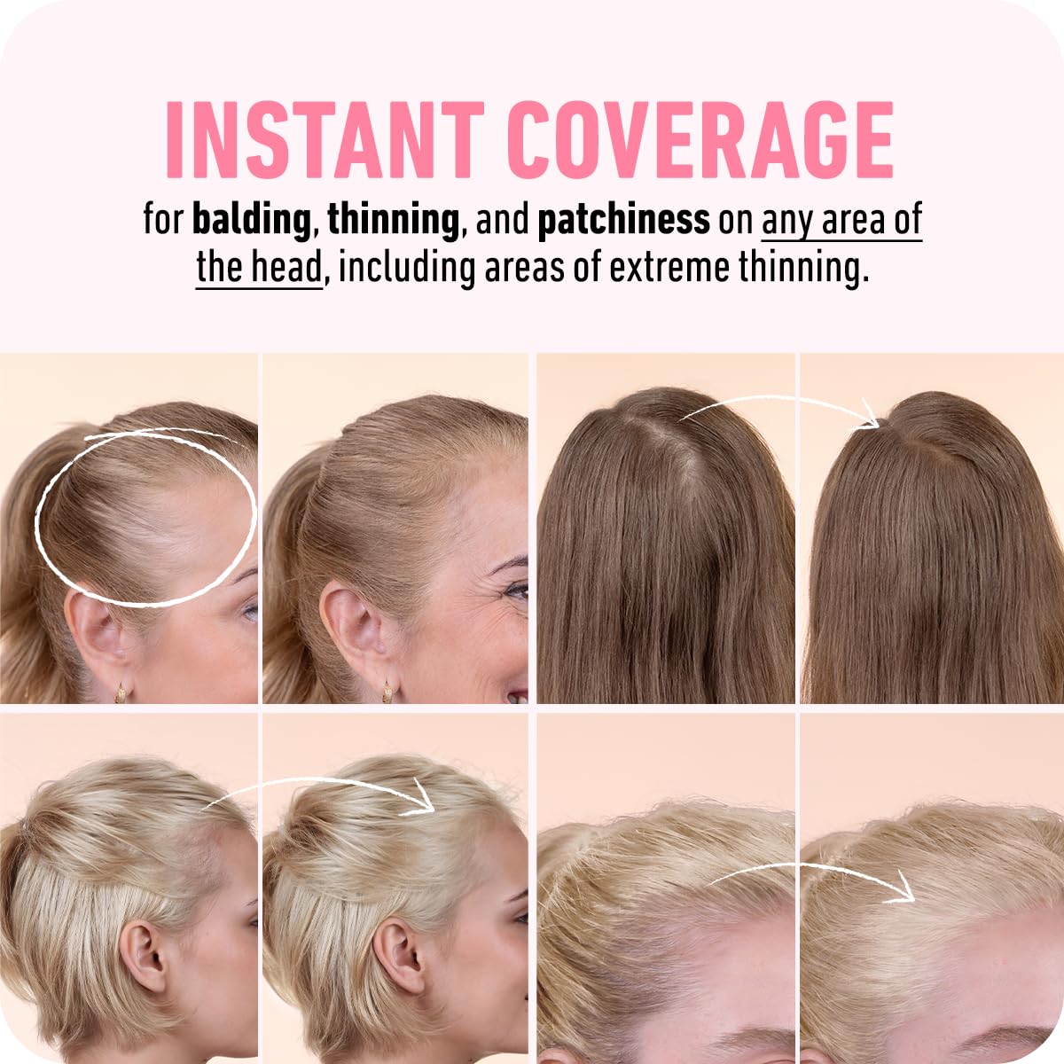 BOLDIFY Hairline Powder - Root Touch Up Hair Color for Gray Coverage - Bald Spot Concealing Hair Powder for Women & Men - 48-Hour Stain-Proof - White