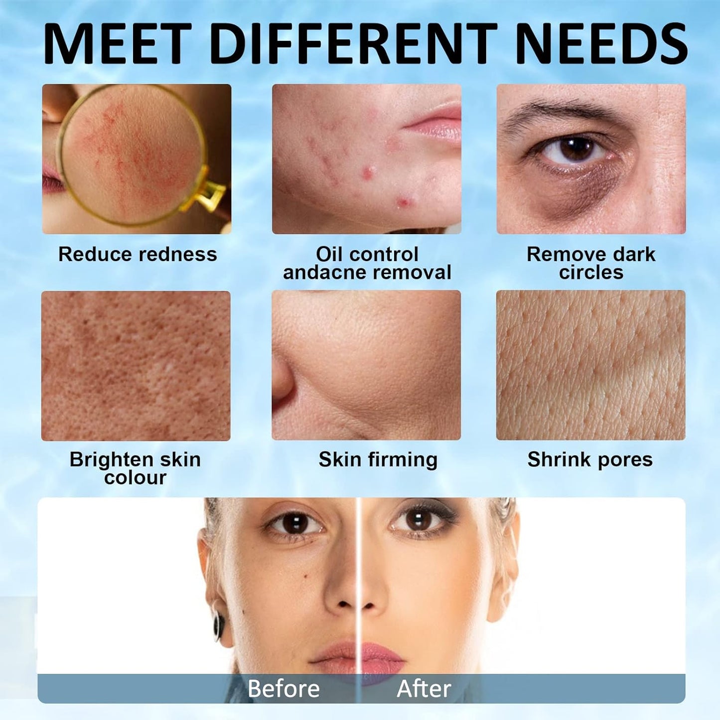 Ice Face Roller, Joyeee Silicone Ice Roller For Face and Eyes Puffiness Relief Reusable Face Ice Cubes Migraine Pain Relief Facial Ice Mold Skincare Tools Gifts for Women Beauty