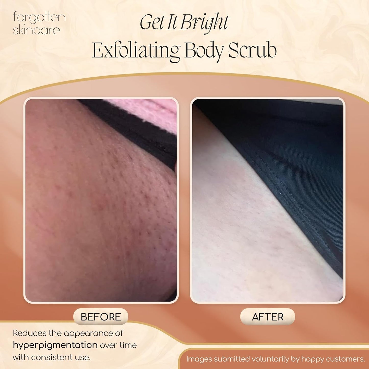 Get It Bright Exfoliating Body Scrub with Glycolic Acid & Pumice for Dark Armpits, Bikini Area, KP Bumps, Rough Skin – Daily AHA Polish to Smooth, Soften & Prep Sensitive Areas