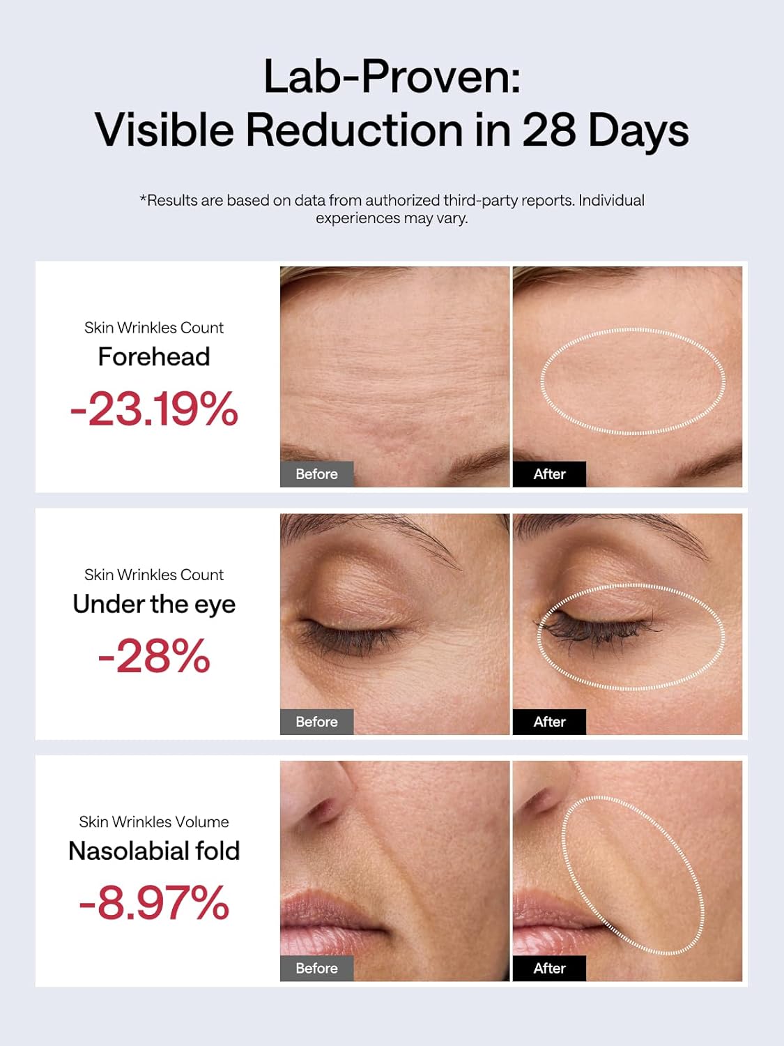 JMOON NouvelleSkin Facial Toning Device, M30U Red Light Therapy for Face, FDA-Cleared for Safer Treatment of Facial Wrinkles, 4 Modes, 5 Energy Levels for Full Face, JMOON Gel Included