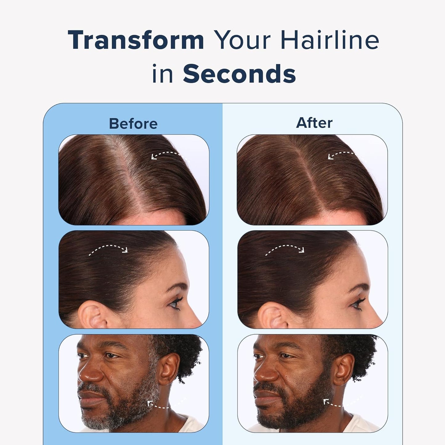 TRUHAIR Color & Conceal Waterproof Root Touch Up Hair Color Concealer - Hair Cover up for Gray Coverage and Hairline Filling - 11 Hair Colors Available (White)